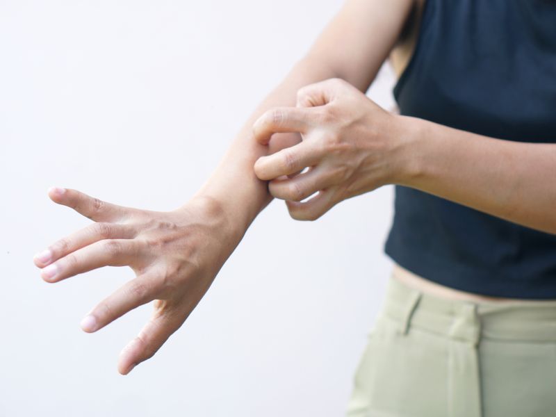Comparing Common Skin Conditions: Causes, Symptoms, & Treatment