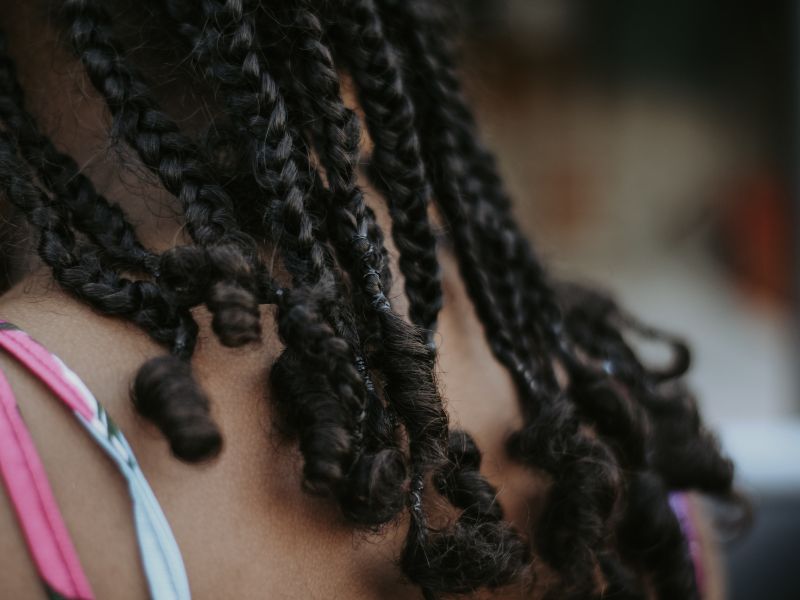 How Scalp Seborrheic Dermatitis & Dandruff Affect People With Black Skin & Textured Hair