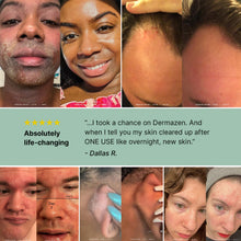 Peaceful Skin System